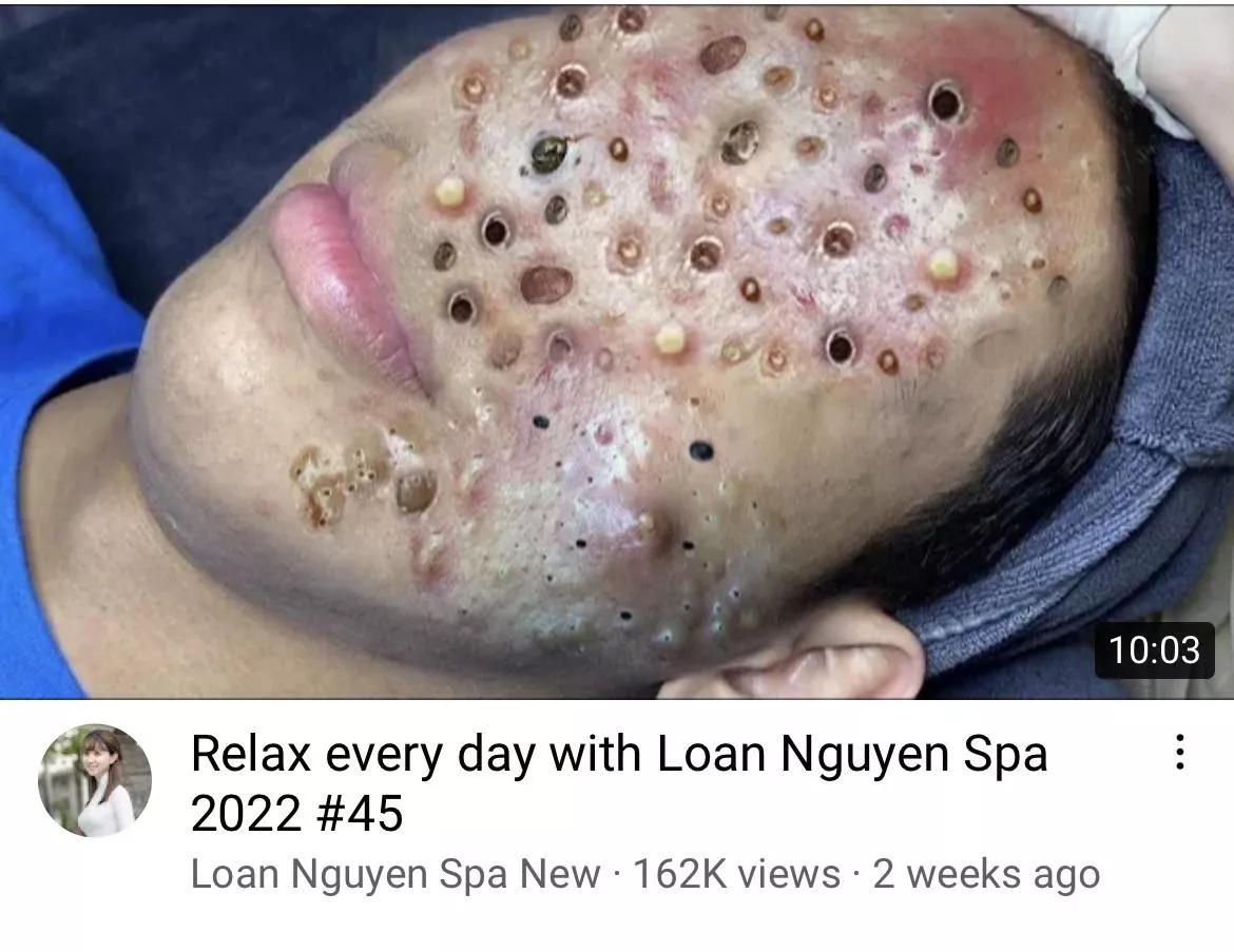 They’ve outdone themselves with this thumbnail