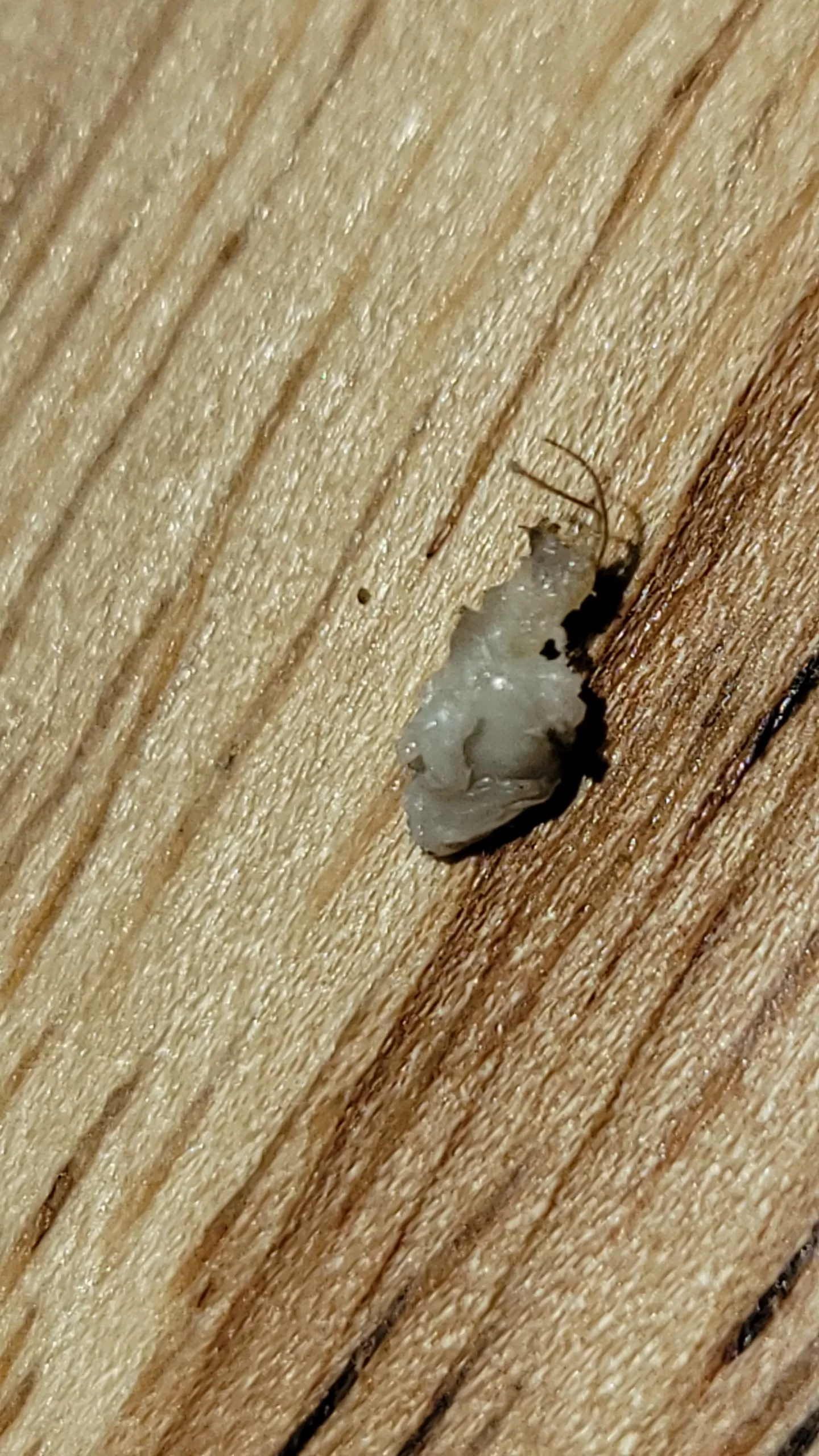 This came out while pulling out an ingrown hair