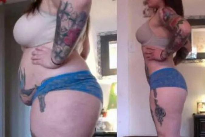 This is from a weight loss ad, but after studying it I'm convinced it's a weight gain, before and after: it's unlikely her underwear went from too tight to perfectly fitting.