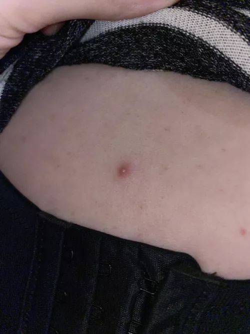 This one hurt. (ignore my bra strap fighting for its life)