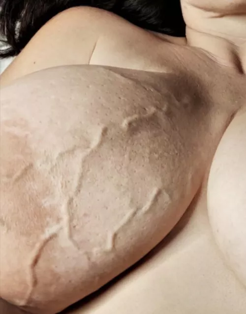 Those veins are like braille...