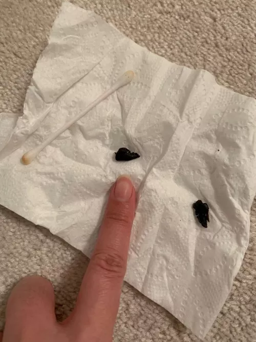 Thought my rabbit had two buttholes, turns out his scent glands were plugged