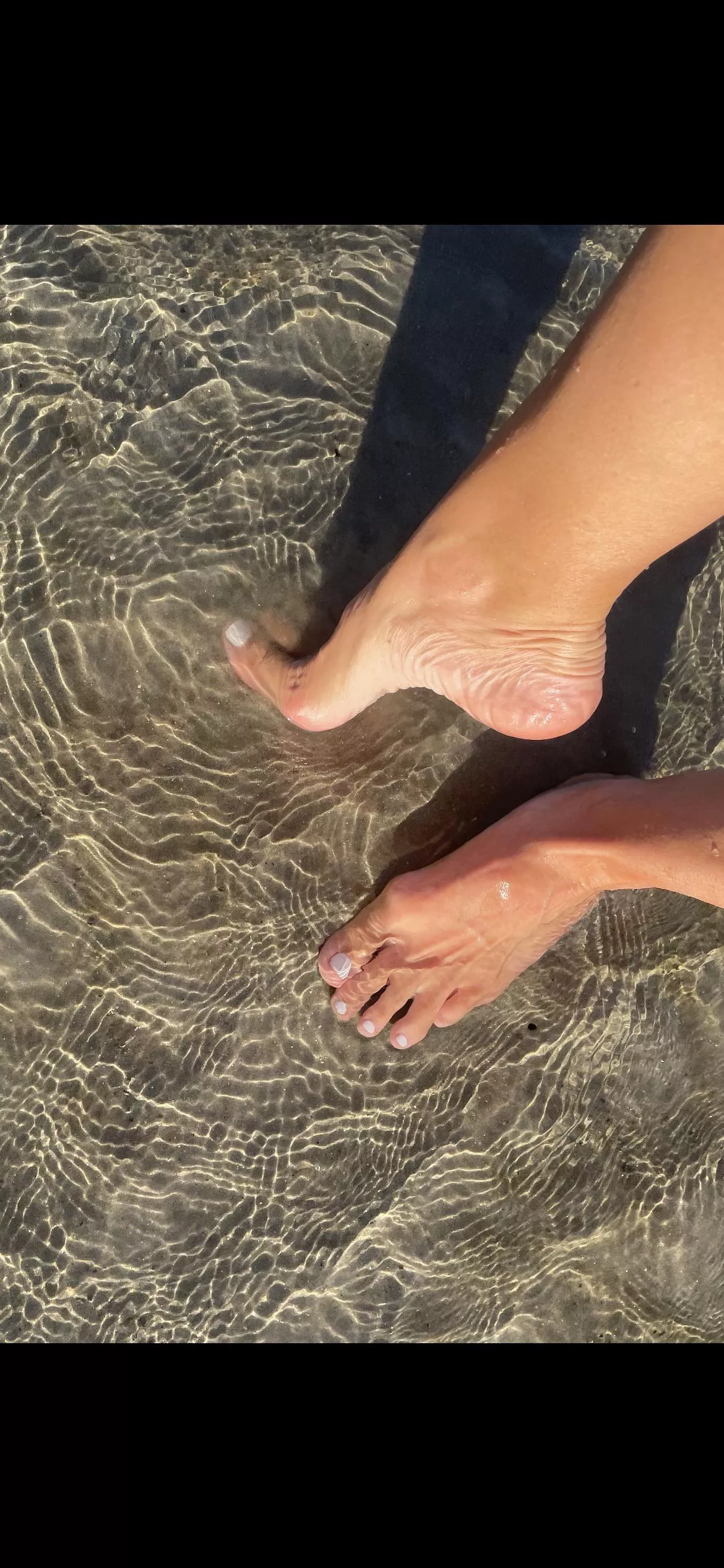 Toes or arch? Xoxo Toes or arch? Xoxo