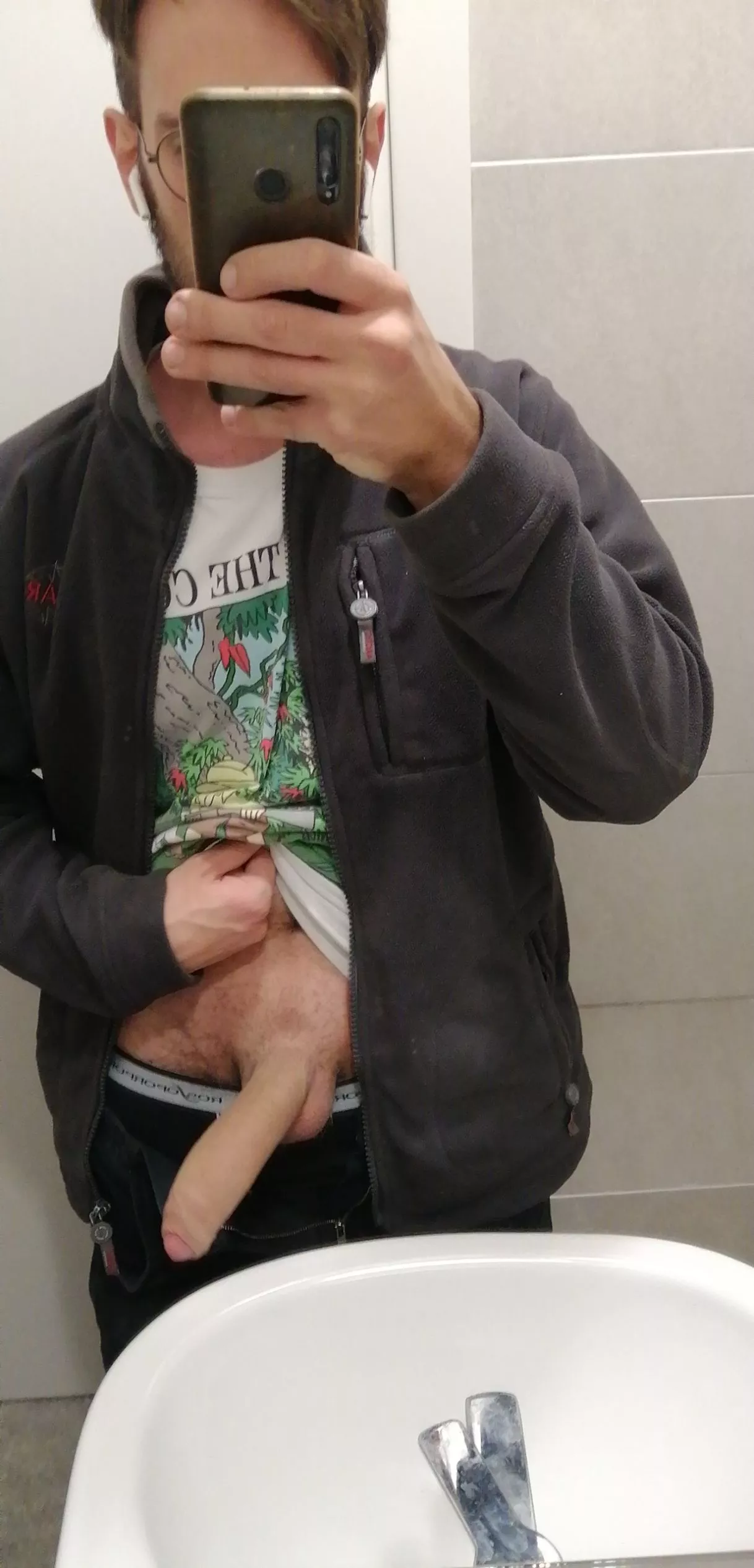 Too much foreskin? Too much foreskin?