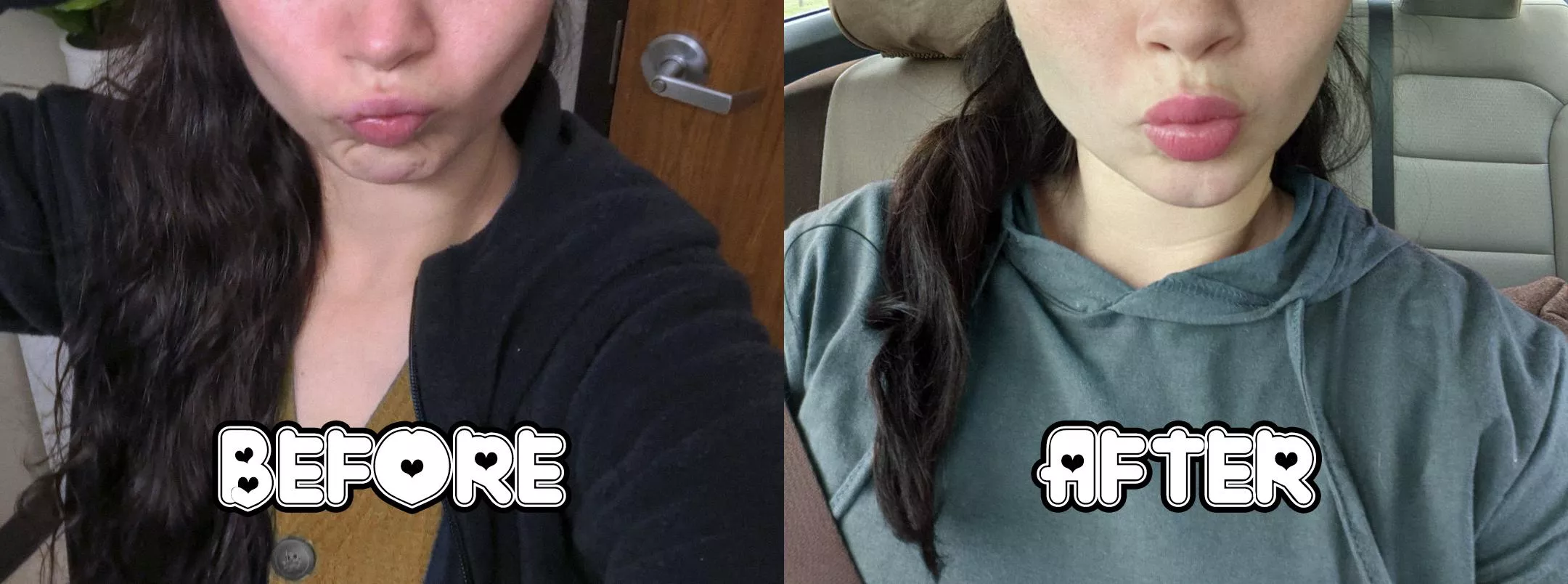 Took my first step last week! π Feel free to give any advice π Took my first step last week! π Feel free to give any advice π