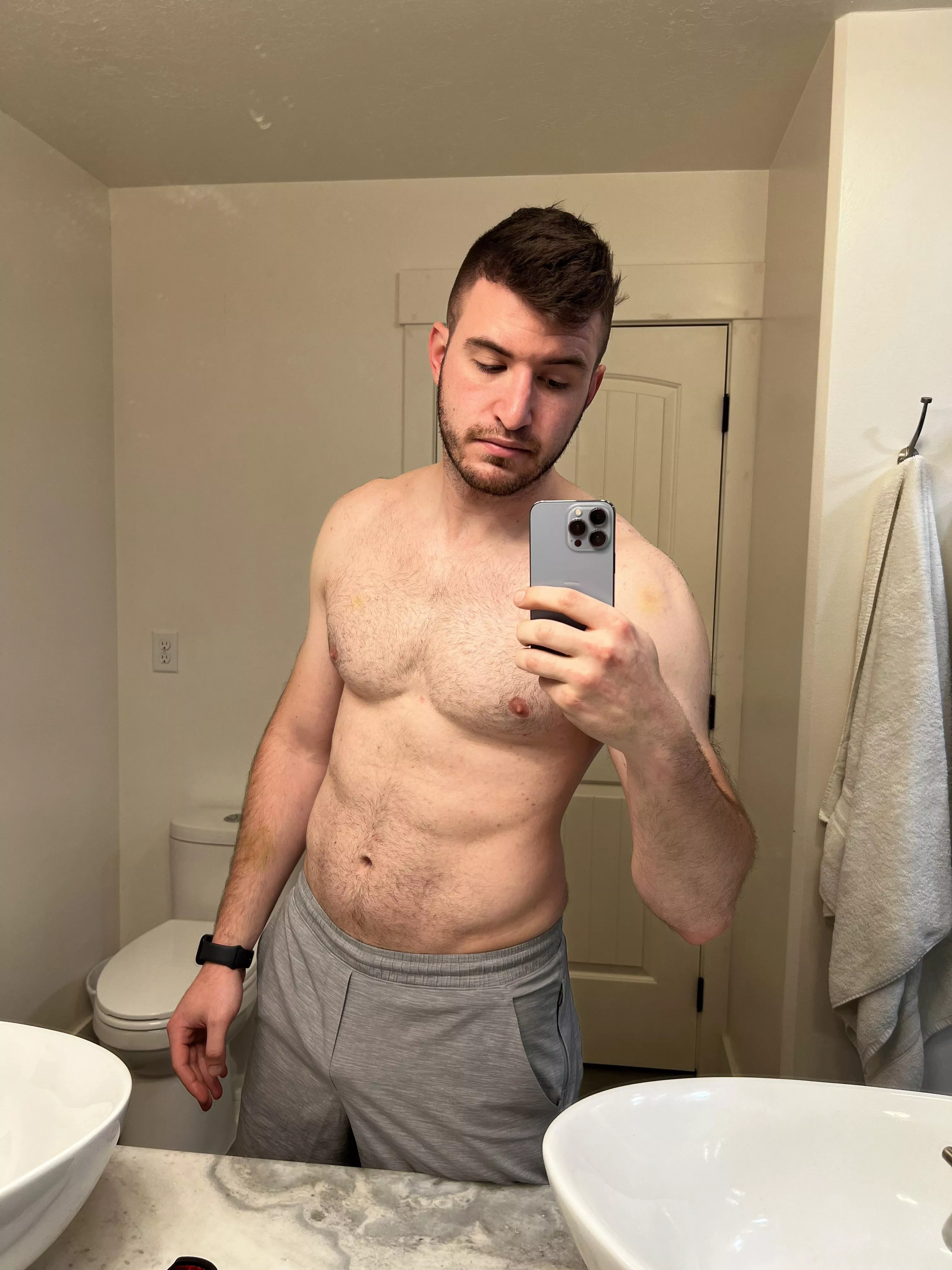 Trimmed or get laser hair removal. What do you guys think?