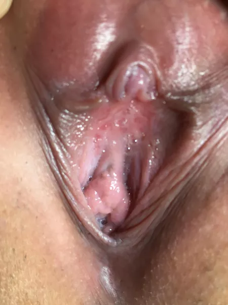 Trying to show you my clit ...but itβs really tiny!