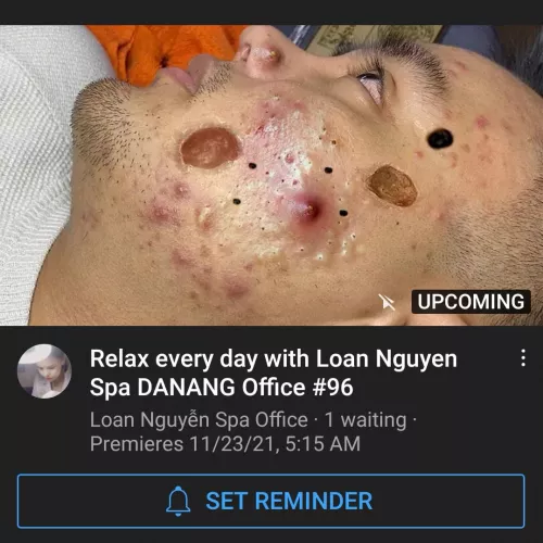 Um? I have many questions. Most of them are
