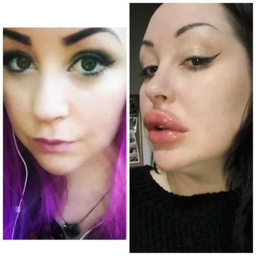 Upgraded my lips again today. Bimbofication is magic!