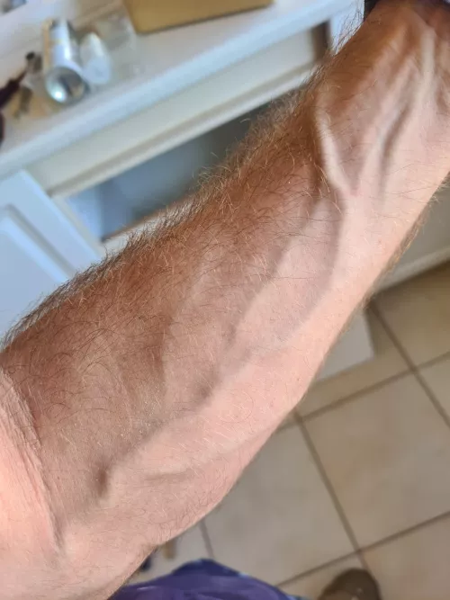 Vascular Vascular