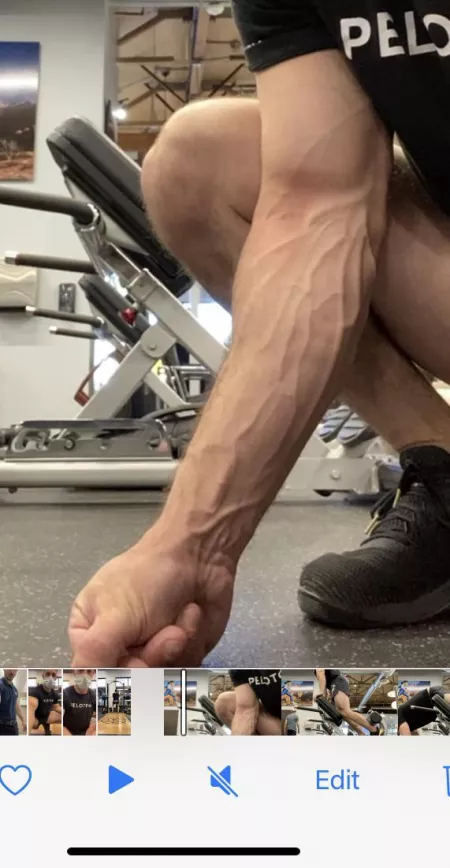 Vascular this morning Vascular this morning