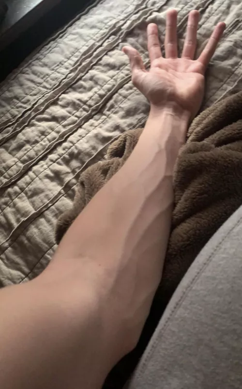 Vein check Vein check
