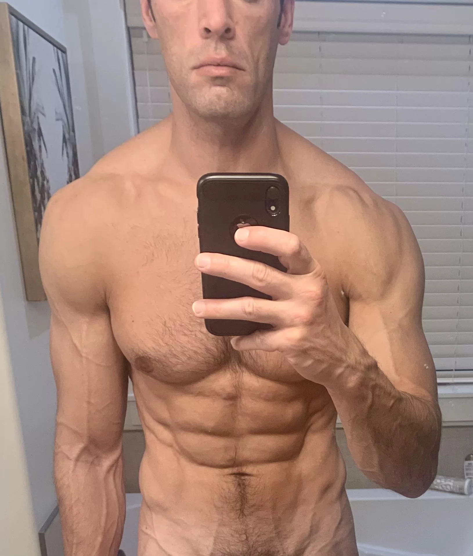 Veins (m) Veins (m)