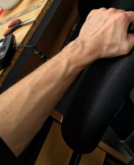 Veins making an appearance on the night shift Veins making an appearance on the night shift