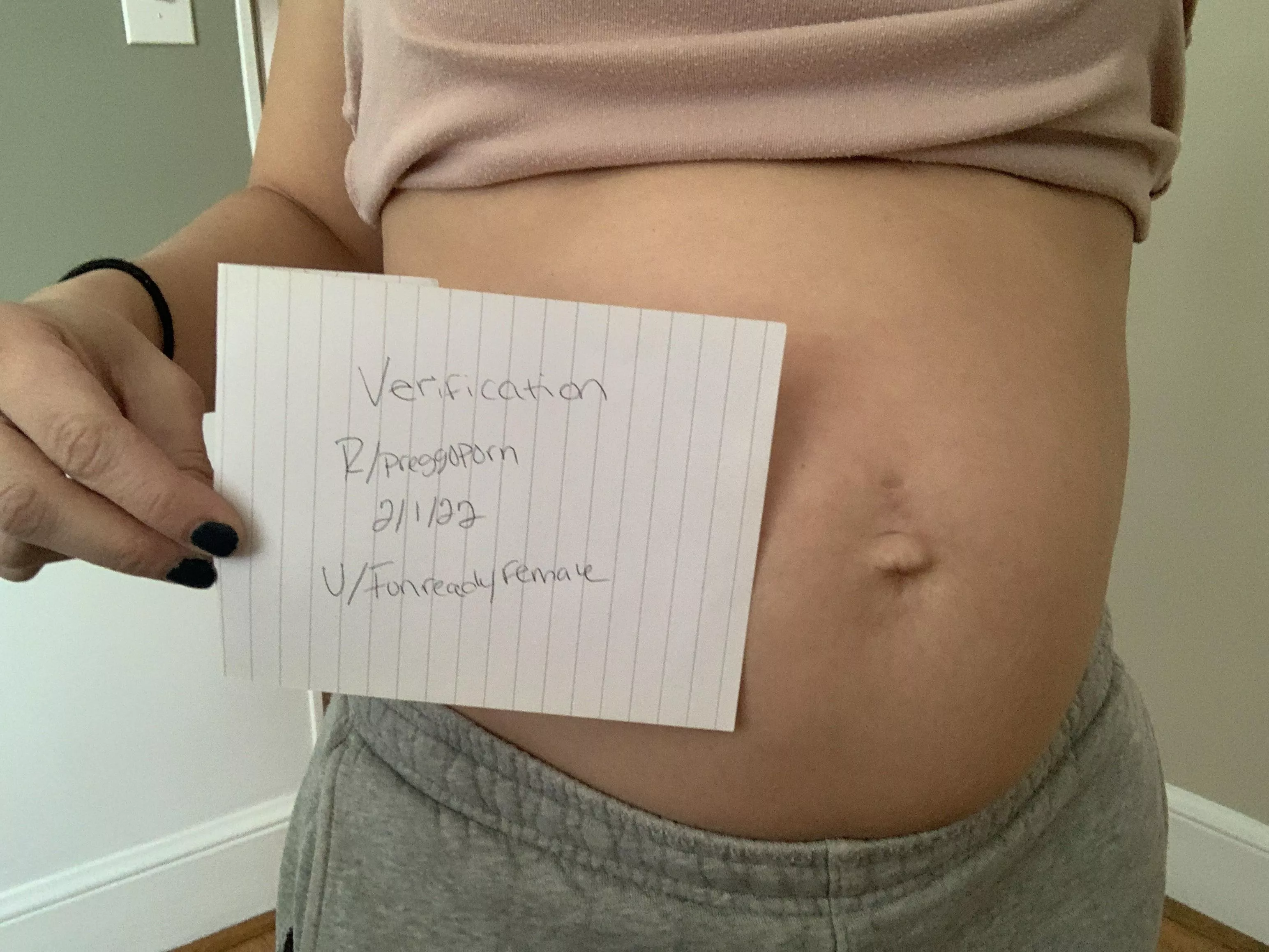 выделение из груди при беременности 32 неделя фото 41