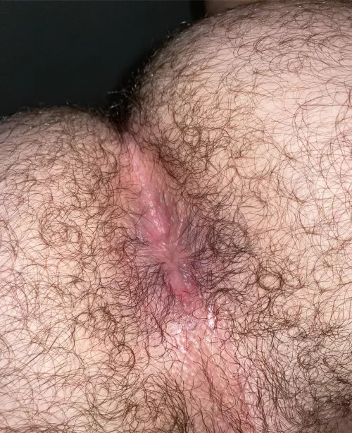 Very hairy Very hairy