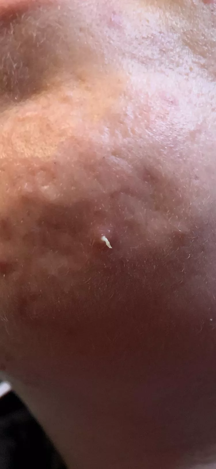 Weird pop on my chin