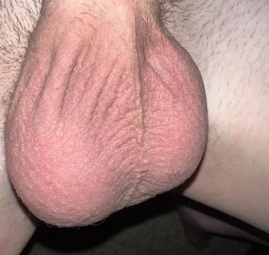 what do u think of my teen balls?
