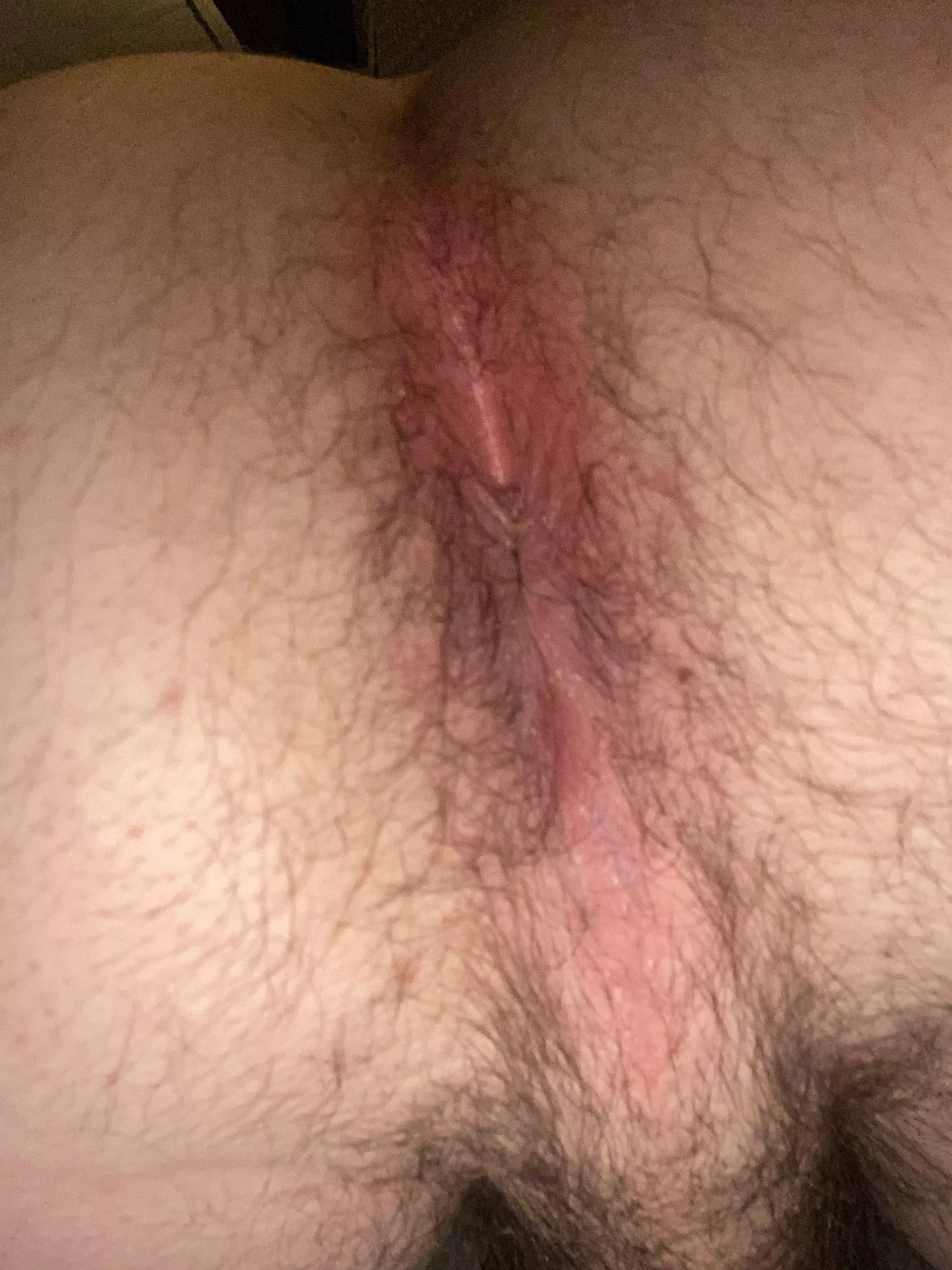 What would you do to my little hole? What would you do to my little hole?