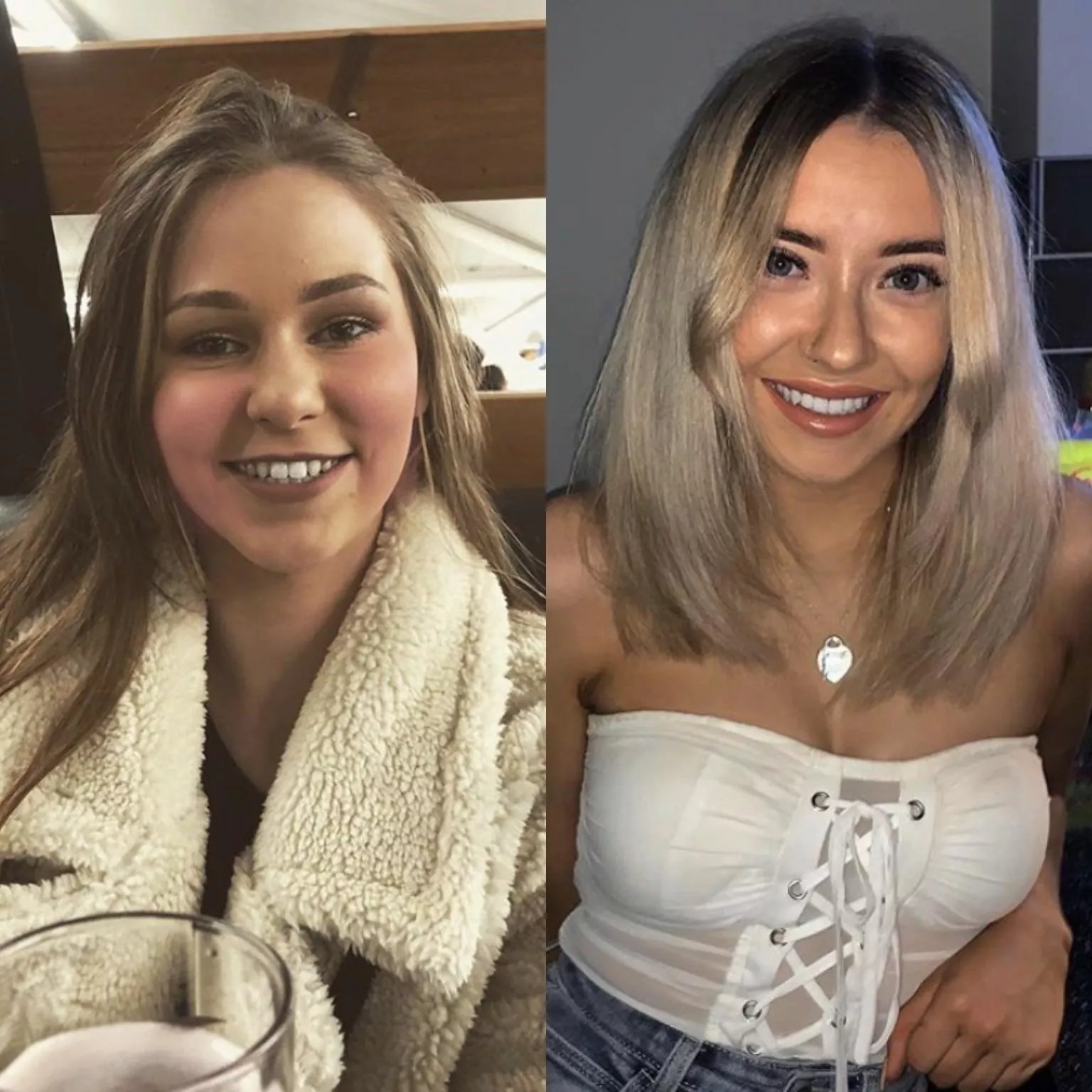 Which face are you grabbing and squashing hard? Why?