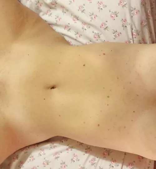 Who likes Birthmarks as much as I do? Who likes Birthmarks as much as I do?