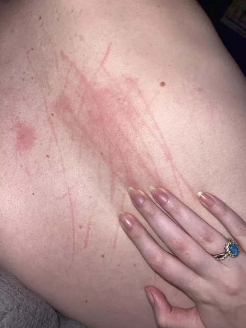 Who wants me to scratch them!! 😈💋