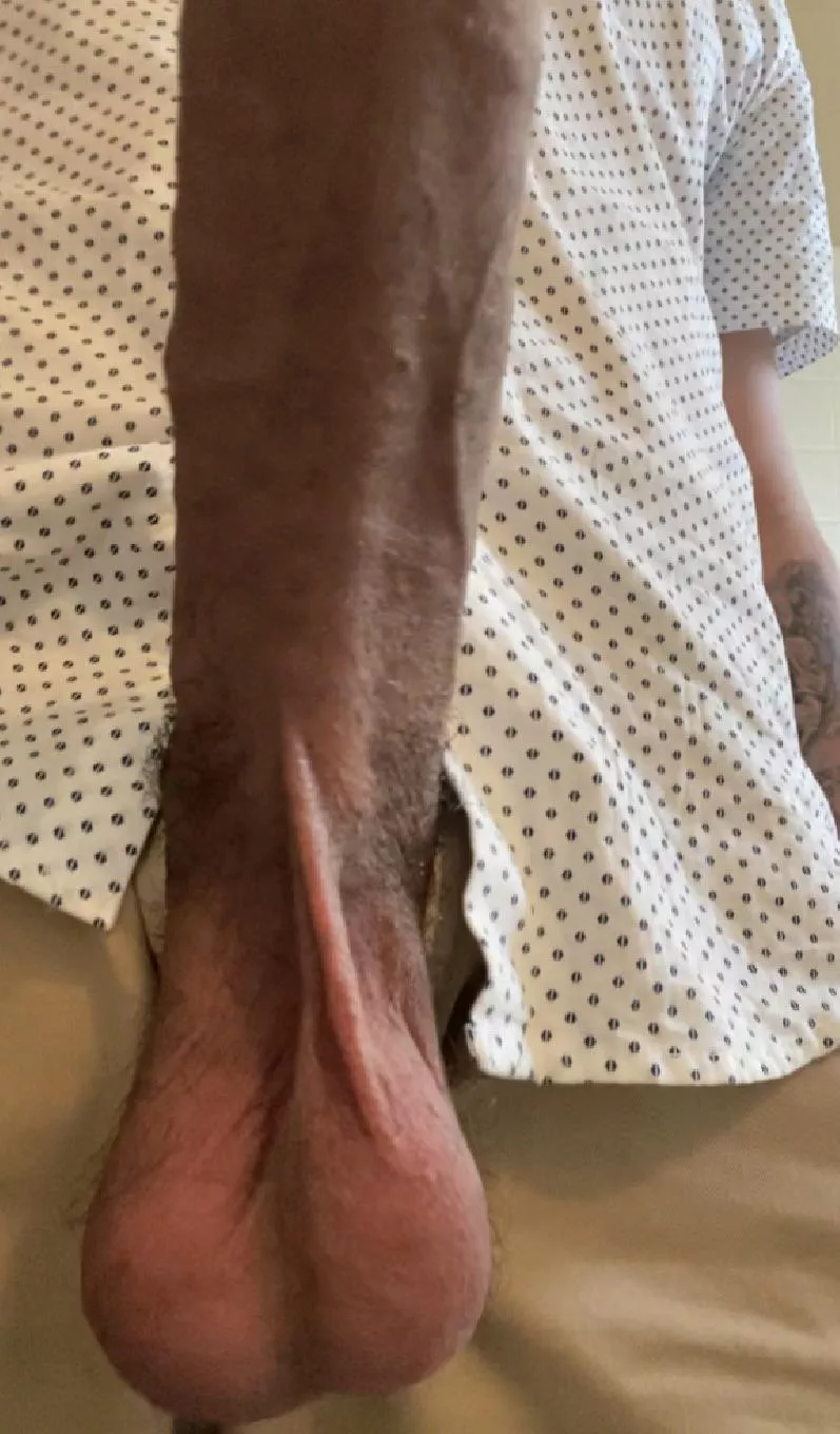 Who wants to suck em? Who wants to suck em?