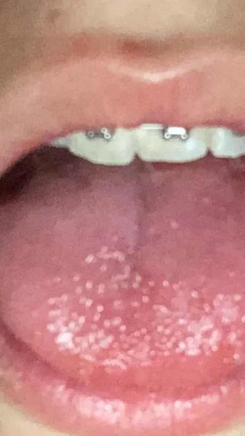 Who would cum on my brackets π€