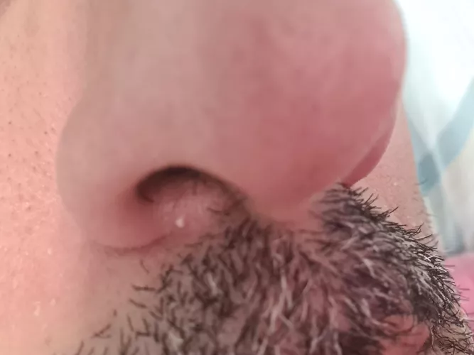 Why this little spot hurts so much 😫😫 I'm not afraid to pop it... but hurts only to touch it.