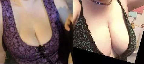 Wife’s growth over a few years and still growing. Wife’s growth over a few years and still growing.
