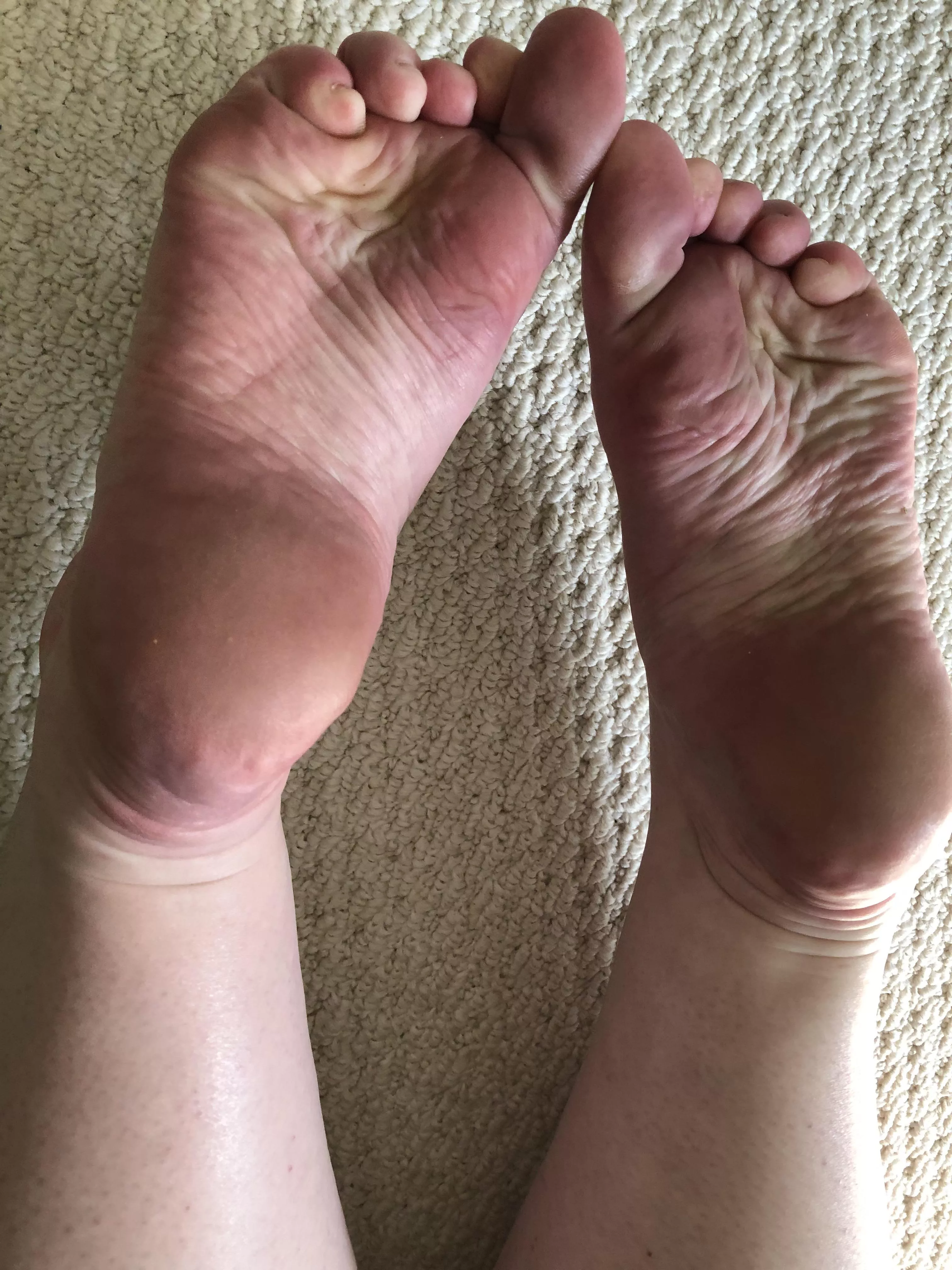 Wrinkled soles and stubby toes Wrinkled soles and stubby toes