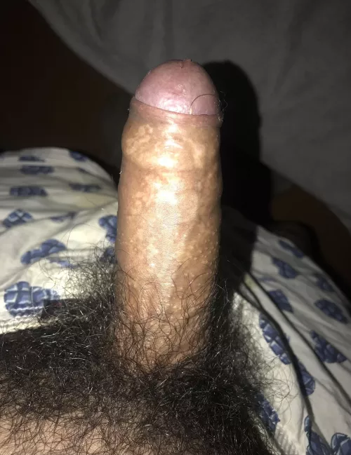 Yeah, itβs hairyβ¦