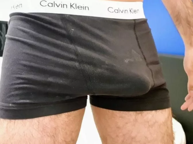 Yes they are white stains.. Yes they are white stains..