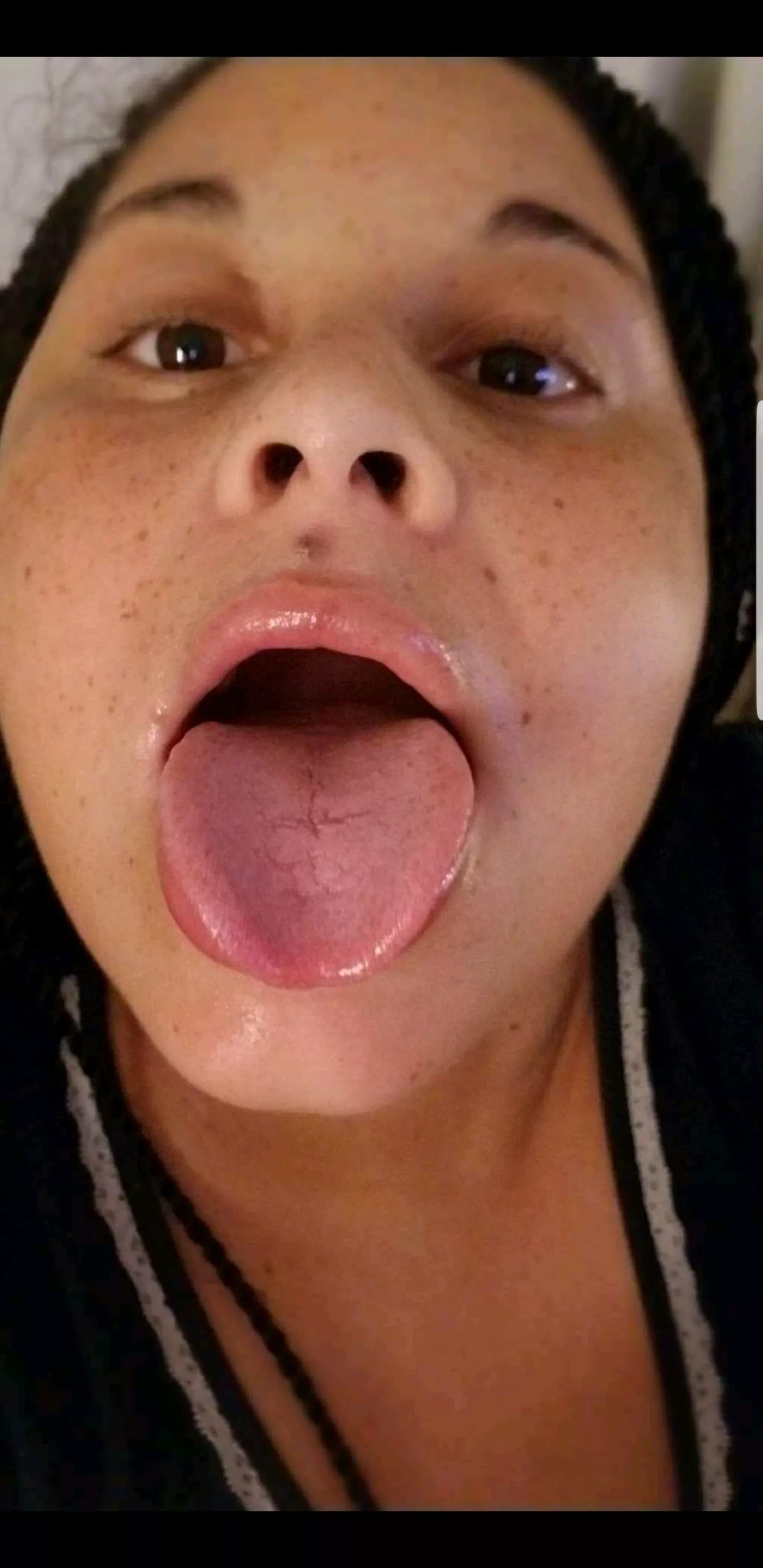 You like my freckles? You like my freckles?